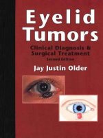 Eyelid Tumors: Clinical Diagnosis and Surgical Treatment