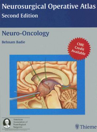 Neuro-Oncology