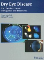 Dry Eye Disease