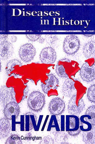 Diseases in History: HIV/AIDS
