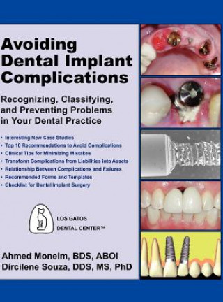 Avoiding Dental Implant Complications