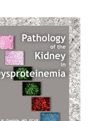 Pathology of the Kidney in Dysproteinemia