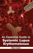 Essential Guide to Systemic Lupus Erythematosus
