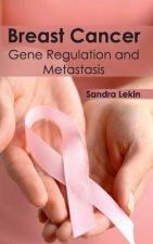 Breast Cancer: Gene Regulation and Metastasis