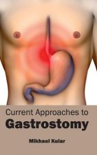 Current Approaches to Gastrostomy