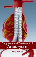 Diagnosis and Treatment of Aneurysm