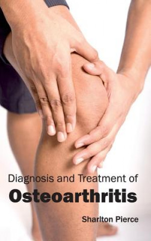 Diagnosis and Treatment of Osteoarthritis
