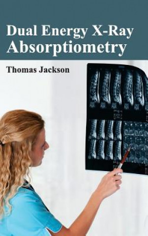 Dual Energy X-Ray Absorptiometry (Thomas Jackson)(Pevná)