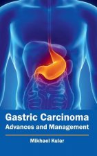 Gastric Carcinoma: Advances and Management