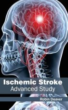 Ischemic Stroke: Advanced Study