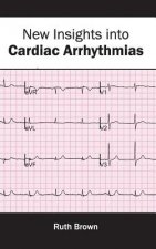New Insights Into Cardiac Arrhythmias