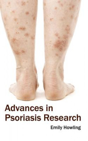 Advances in Psoriasis Research
