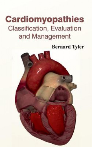 Cardiomyopathies: Classification, Evaluation and Management