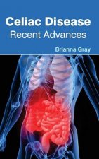 Celiac Disease: Recent Advances