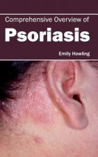 Comprehensive Overview of Psoriasis