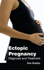 Ectopic Pregnancy: Diagnosis and Treatment