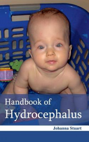 Handbook of Hydrocephalus