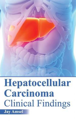 Hepatocellular Carcinoma: Clinical Findings