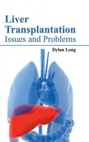 Liver Transplantation: Issues and Problems