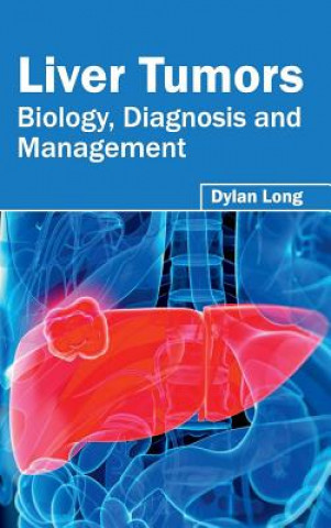 Liver Tumors: Biology, Diagnosis and Management