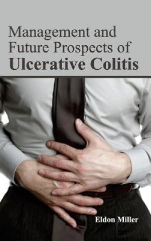 Management and Future Prospects of Ulcerative Colitis