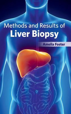 Methods and Results of Liver Biopsy