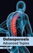 Osteoporosis: Advanced Topics