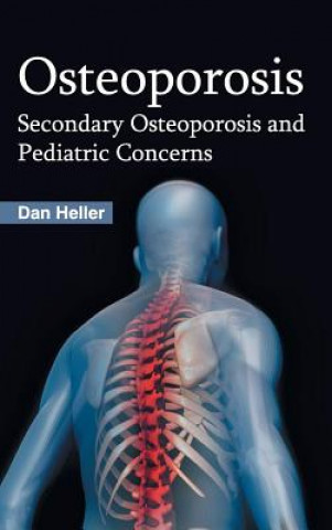 Osteoporosis: Secondary Osteoporosis and Pediatric Concerns