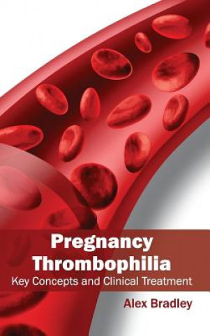 Pregnancy Thrombophilia: Key Concepts and Clinical Treatment