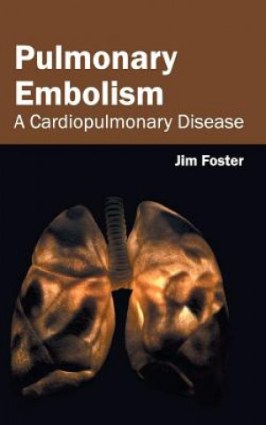 Pulmonary Embolism: A Cardiopulmonary Disease