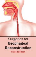 Surgeries for Esophageal Reconstruction