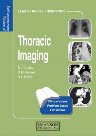 Thoracic Imaging: Self-Assessment Colour Review