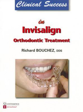 Clinical Success in Invisalign Orthodontic Treatment