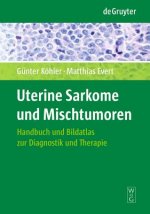 Uterine Sarkome und Mischtumoren