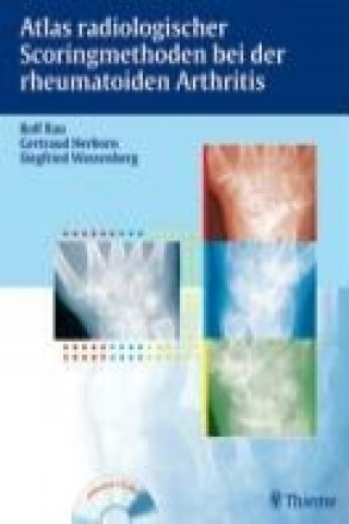 Atlas radiologischer Scoringmethoden bei der rheumatoiden Arthritis