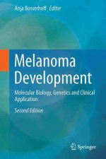 Melanoma Development