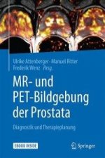 MR- und PET-Bildgebung der Prostata