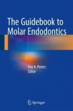 Guidebook to Molar Endodontics