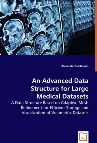 An Advanced Data Structure for Large Medical Datasets
