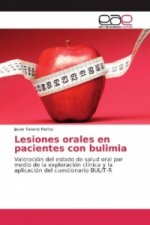 Lesiones orales en pacientes con bulimia