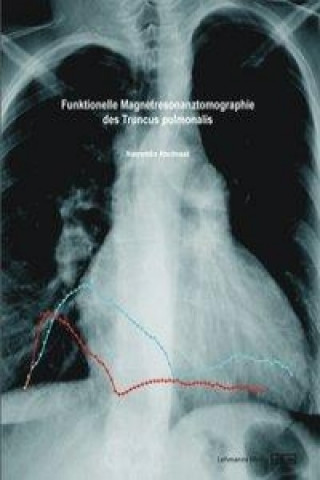 Funktionelle Magnetresonanztomographie des Truncus pulmonalis