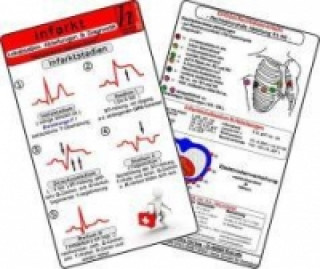 Infarkt - Lokalisation, Ableitungen & Diagnostik - Medizinische Taschen-Karte