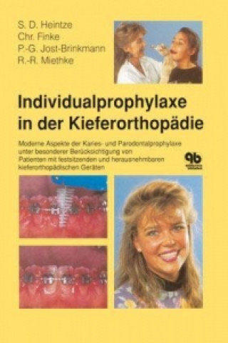 Individualprophylaxe in der Kieferorthopädie