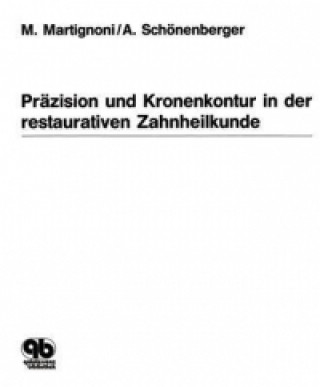 Präzision und Kronenkontur in der restaurativen Zahnheilkunde