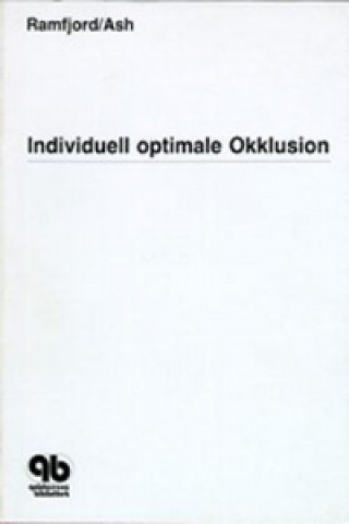 Individuell optimale Okklusion