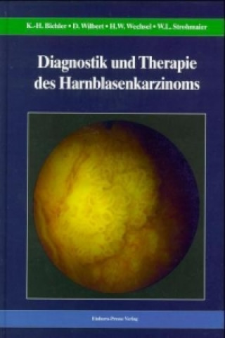 Diagnostik und Therapie des Harnblasenkarzinoms