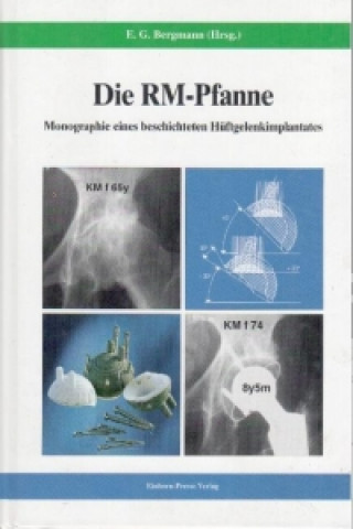 Die RM-Pfanne