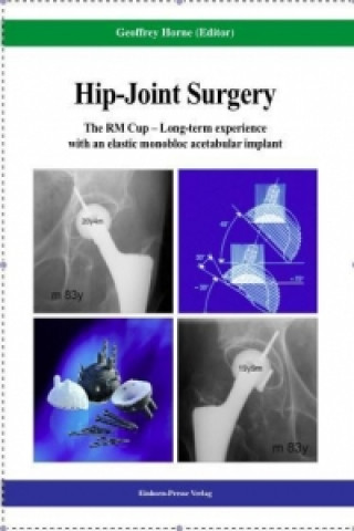 Hip-Joint Surgery