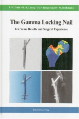 The Gamma Locking Nail