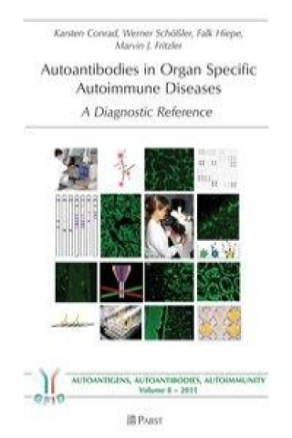 Autoantibodies in Organ Specific Autoimmune Diseases
